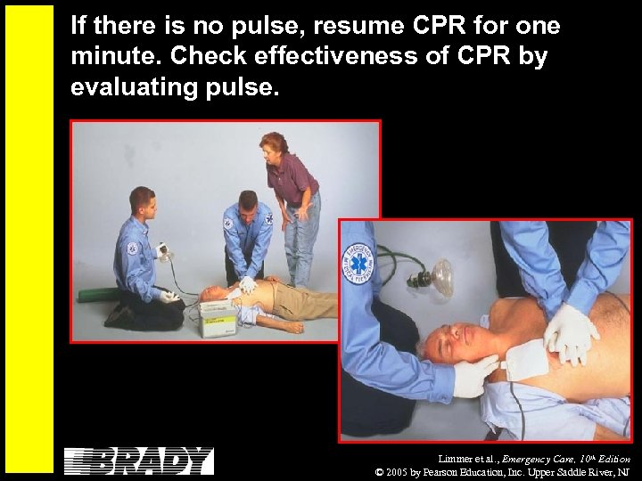 If there is no pulse, resume CPR for one minute. Check effectiveness of CPR