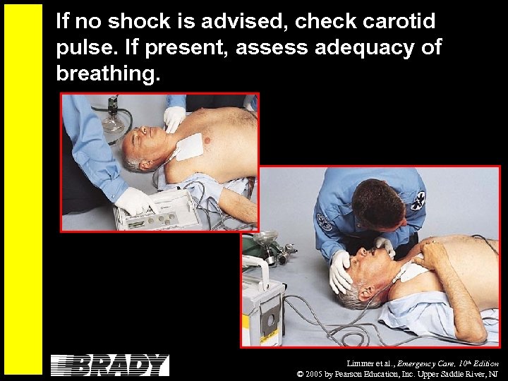 If no shock is advised, check carotid pulse. If present, assess adequacy of breathing.