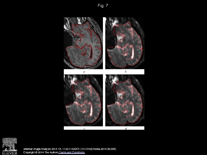 Fig. 7 Medical Image Analysis 2014 18, 1132 -1142 DOI: (10. 1016/j. media. 2014.