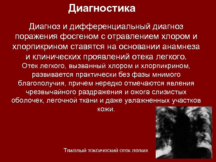 Диагностика Диагноз и дифференциальный диагноз поражения фосгеном с отравлением хлором и хлорпикрином ставятся на