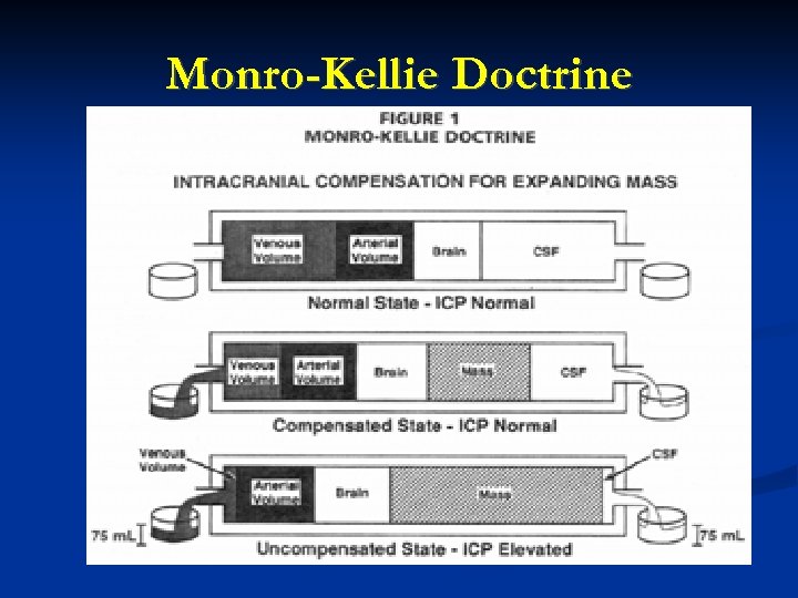 Monro-Kellie Doctrine 