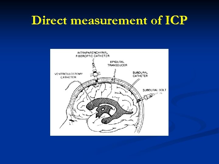 Direct measurement of ICP 