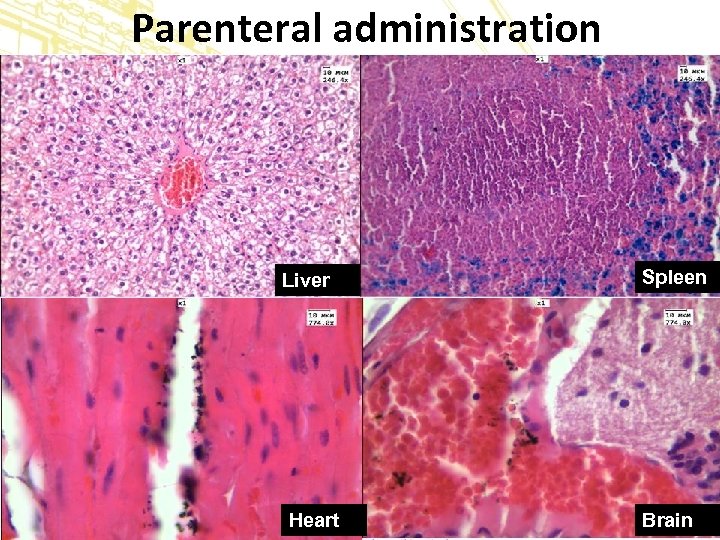 Parenteral administration Liver Heart Spleen Brain 