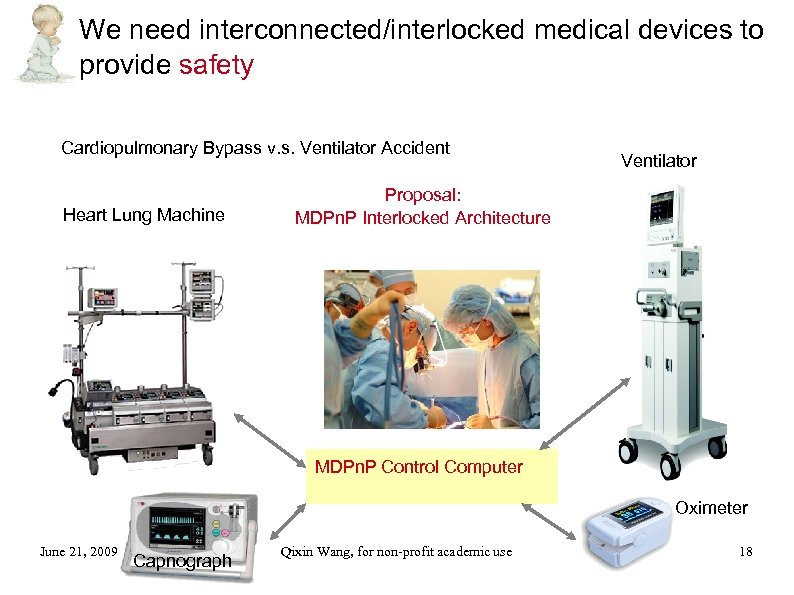 We need interconnected/interlocked medical devices to provide safety Cardiopulmonary Bypass v. s. Ventilator Accident