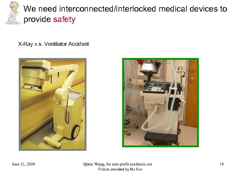 We need interconnected/interlocked medical devices to provide safety X-Ray v. s. Ventilator Accident June