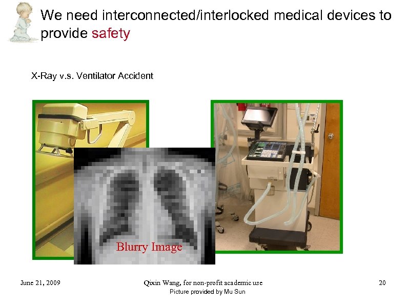 We need interconnected/interlocked medical devices to provide safety X-Ray v. s. Ventilator Accident Blurry