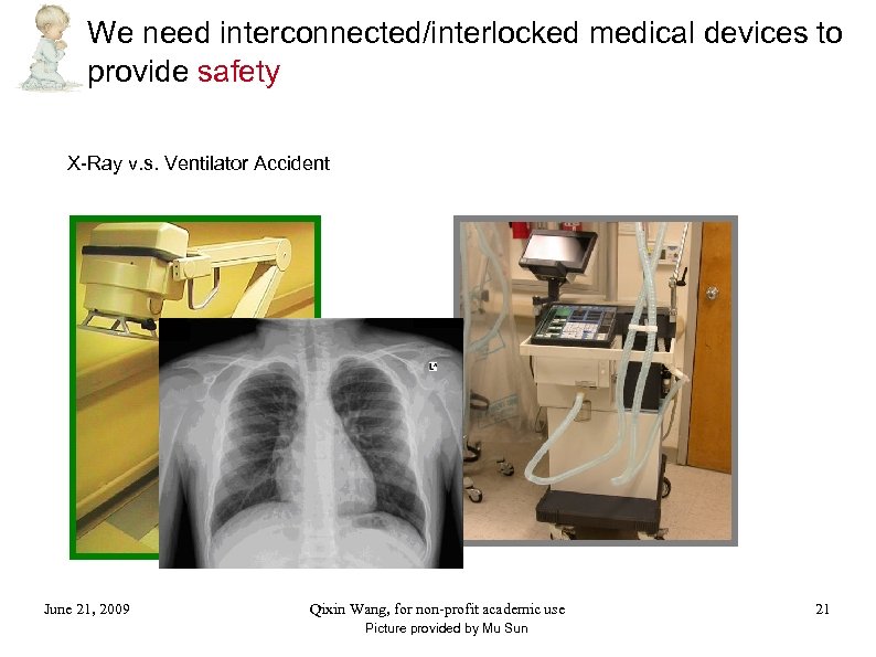 We need interconnected/interlocked medical devices to provide safety X-Ray v. s. Ventilator Accident June