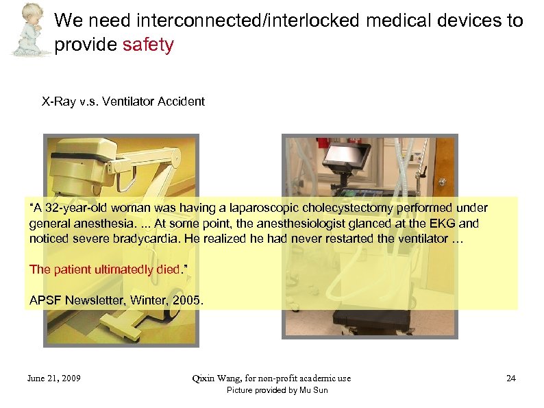 We need interconnected/interlocked medical devices to provide safety X-Ray v. s. Ventilator Accident “A