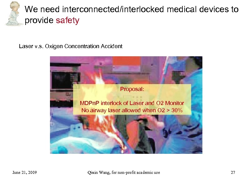 We need interconnected/interlocked medical devices to provide safety Laser v. s. Oxigen Concentration Accident