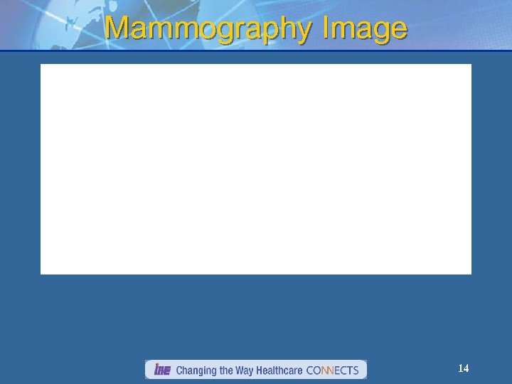 Mammography Image 14 