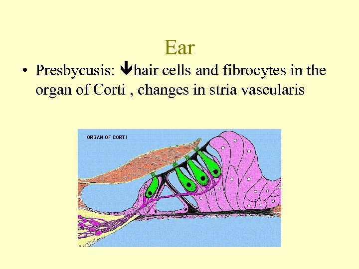 Ear • Presbycusis: hair cells and fibrocytes in the organ of Corti , changes