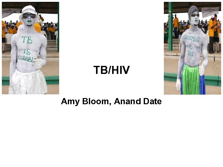 TB/HIV Amy Bloom, Anand Date 