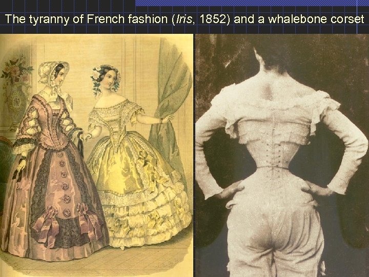 The tyranny of French fashion (Iris, 1852) and a whalebone corset 