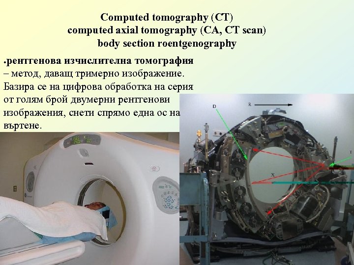 Computed tomography (CT) computed axial tomography (CA, CT scan) body section roentgenography рентгенова изчислителна