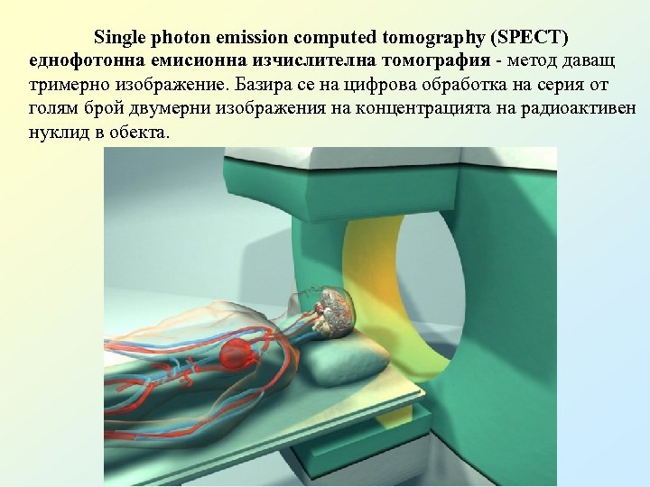 Single photon emission computed tomography (SPECT) еднофотонна емисионна изчислителна томография - метод даващ тримерно
