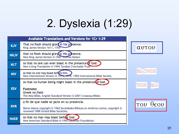 2. Dyslexia (1: 29) 35 