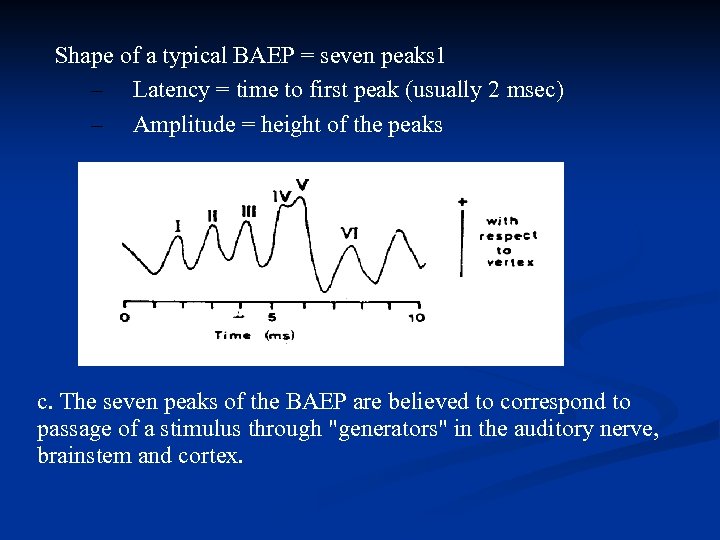 Shape of a typical BAEP = seven peaks 1 – Latency = time to