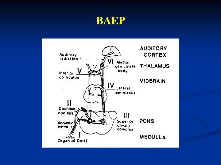 BAEP 