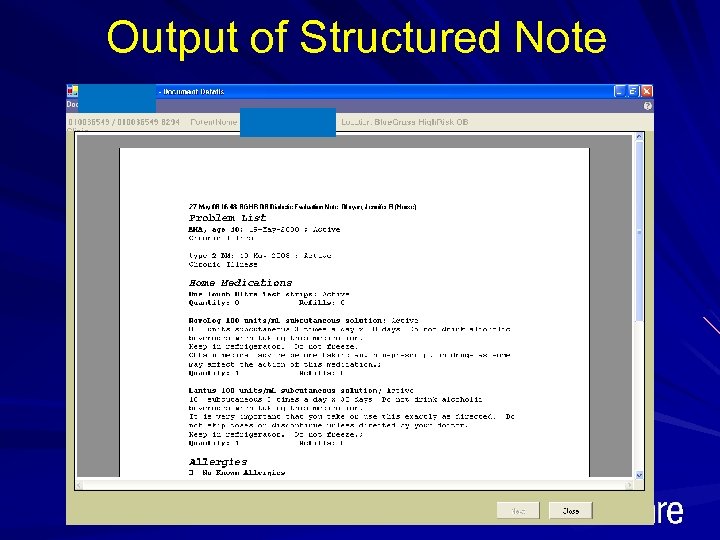 Output of Structured Note 