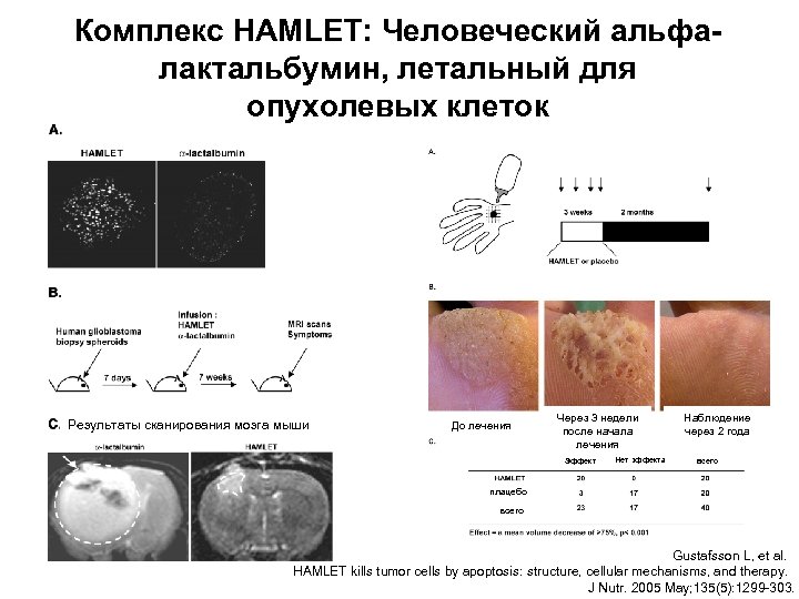 Комплекс HAMLET: Человеческий альфалактальбумин, летальный для опухолевых клеток Результаты сканирования мозга мыши До лечения