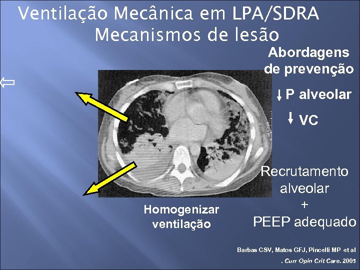 Ventilação Mecânica em LPA/SDRA Mecanismos de lesão Abordagens de prevenção P alveolar VC Homogenizar
