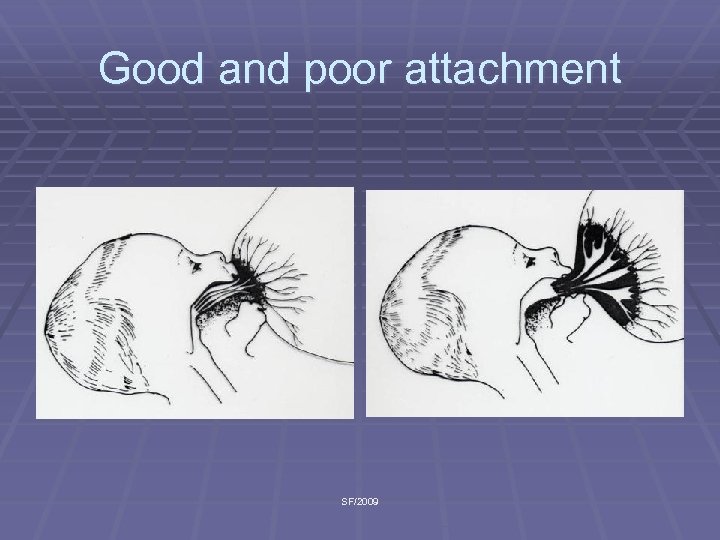 Good and poor attachment SF/2009 