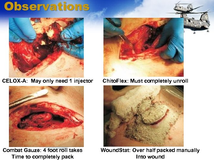 Observations CELOX-A: May only need 1 injector Combat Gauze: 4 foot roll takes Time