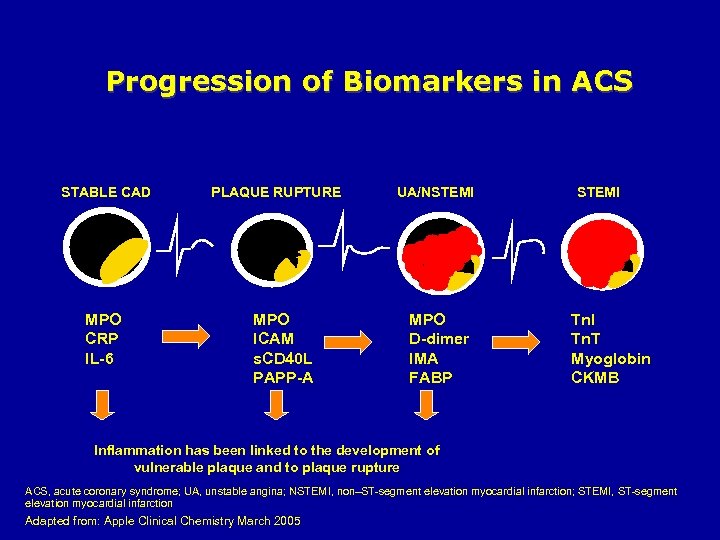 Progression of Biomarkers in ACS STABLE CAD MPO CRP IL-6 PLAQUE RUPTURE MPO ICAM