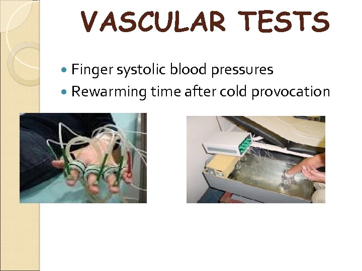 VASCULAR TESTS Finger systolic blood pressures Rewarming time after cold provocation 