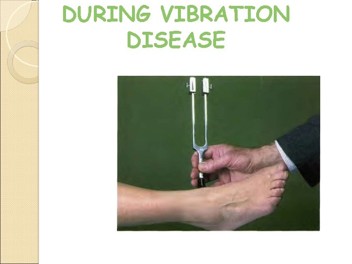 DURING VIBRATION DISEASE 