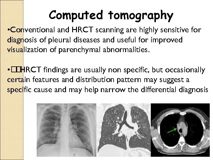 Computed tomography • Conventional and HRCT scanning are highly sensitive for diagnosis of pleural