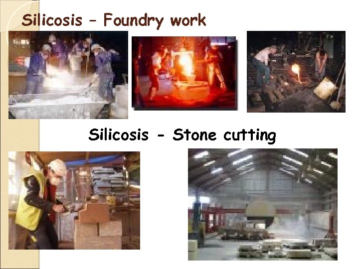 Silicosis – Foundry work Silicosis - Stone cutting 