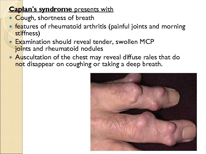 Caplan's syndrome presents with Cough, shortness of breath features of rheumatoid arthritis (painful joints