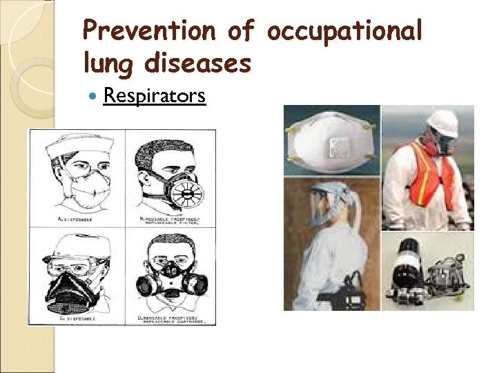 Prevention of occupational lung diseases Respirators 