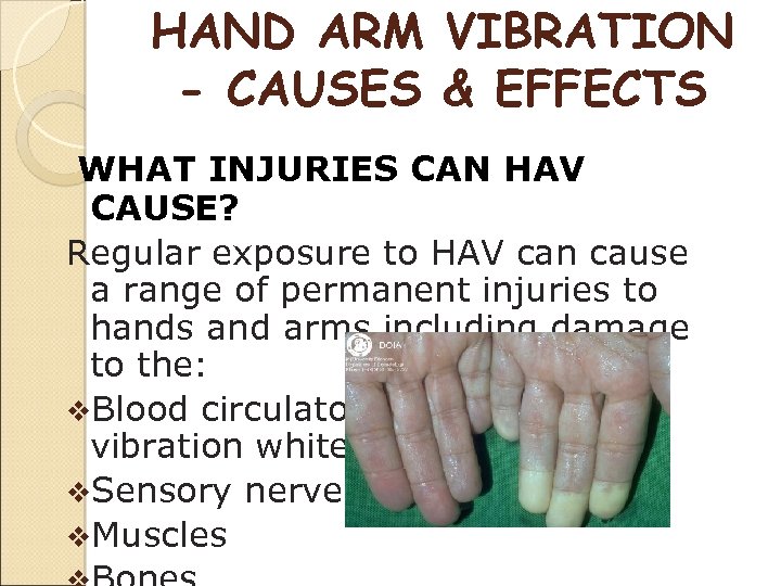 HAND ARM VIBRATION - CAUSES & EFFECTS WHAT INJURIES CAN HAV CAUSE? Regular exposure