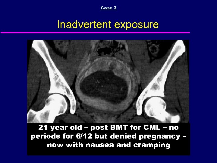 CT and MRI in pregnancy and lactation Fergus