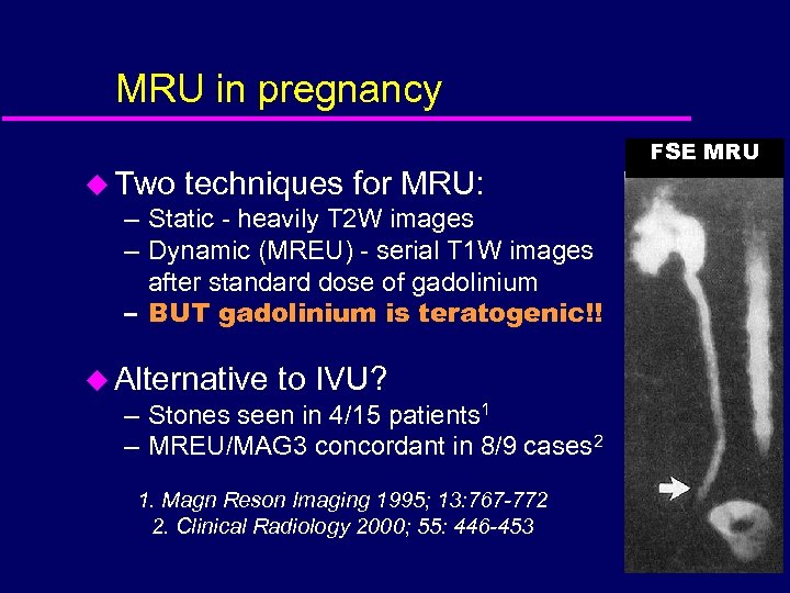 MRU in pregnancy u Two techniques for MRU: – Static - heavily T 2