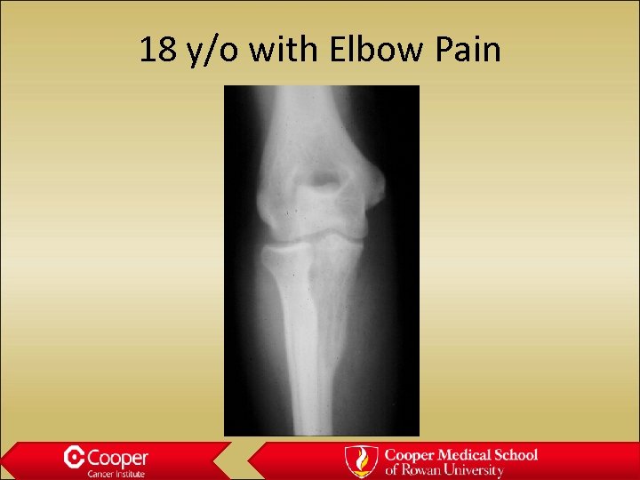 18 y/o with Elbow Pain 