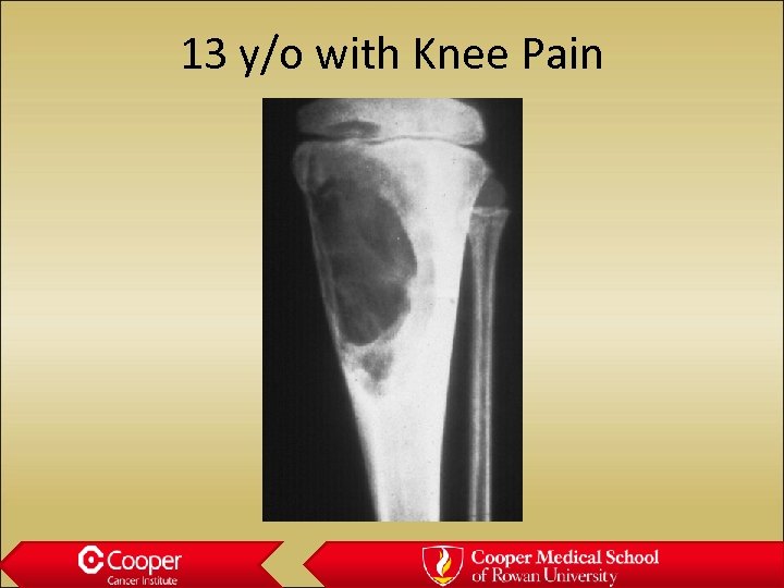 13 y/o with Knee Pain 