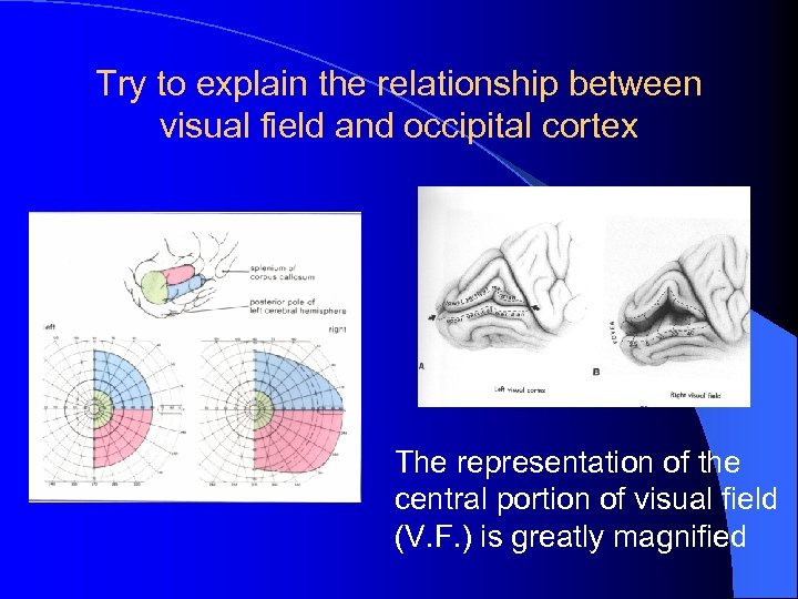 Try to explain the relationship between visual field and occipital cortex The representation of