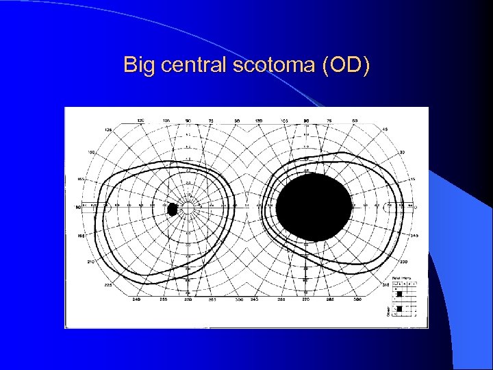 Big central scotoma (OD) 