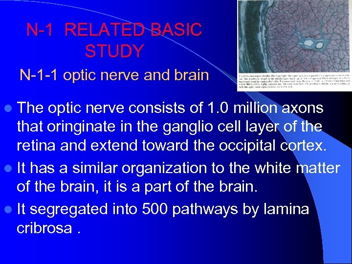 N-1 RELATED BASIC STUDY N-1 -1 optic nerve and brain l The optic nerve