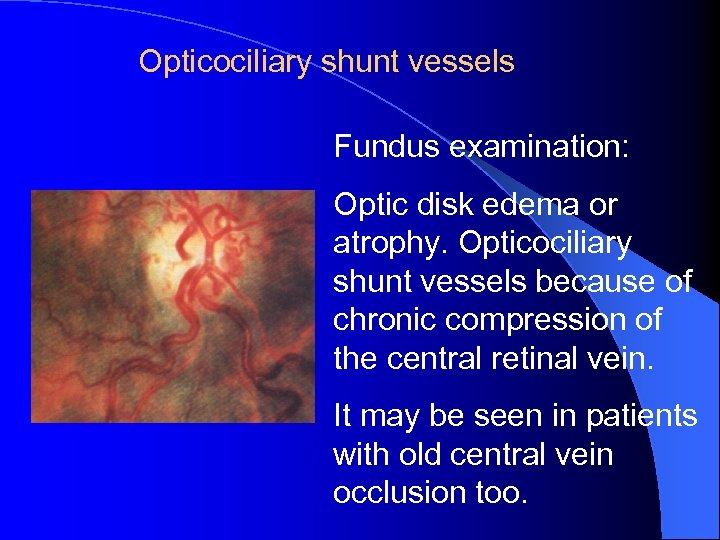 Opticociliary shunt vessels Fundus examination: Optic disk edema or atrophy. Opticociliary shunt vessels because