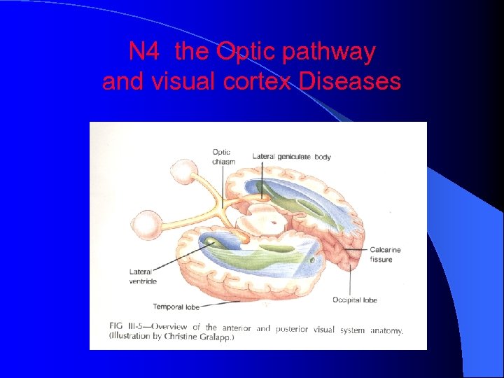 N 4 the Optic pathway and visual cortex Diseases 