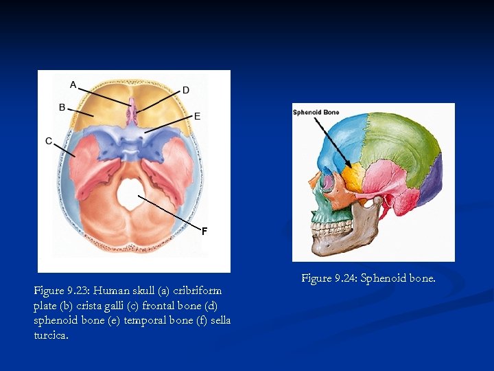 Figure 9. 23: Human skull (a) cribriform plate (b) crista galli (c) frontal bone