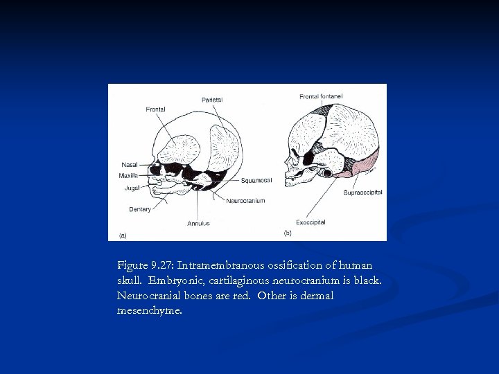 Figure 9. 27: Intramembranous ossification of human skull. Embryonic, cartilaginous neurocranium is black. Neurocranial