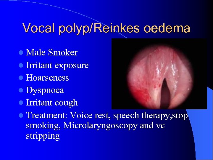 Vocal polyp/Reinkes oedema l Male Smoker l Irritant exposure l Hoarseness l Dyspnoea l