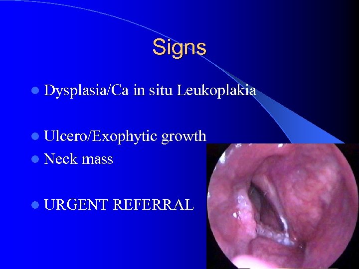 Signs l Dysplasia/Ca in situ Leukoplakia l Ulcero/Exophytic l Neck growth mass l URGENT