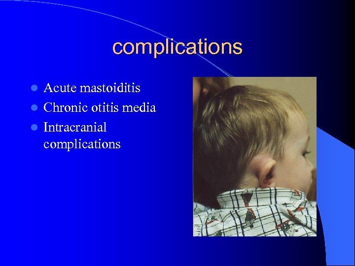 complications Acute mastoiditis l Chronic otitis media l Intracranial complications l 