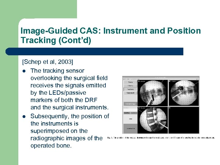 Image-Guided CAS: Instrument and Position Tracking (Cont’d) [Schep et al, 2003] l The tracking